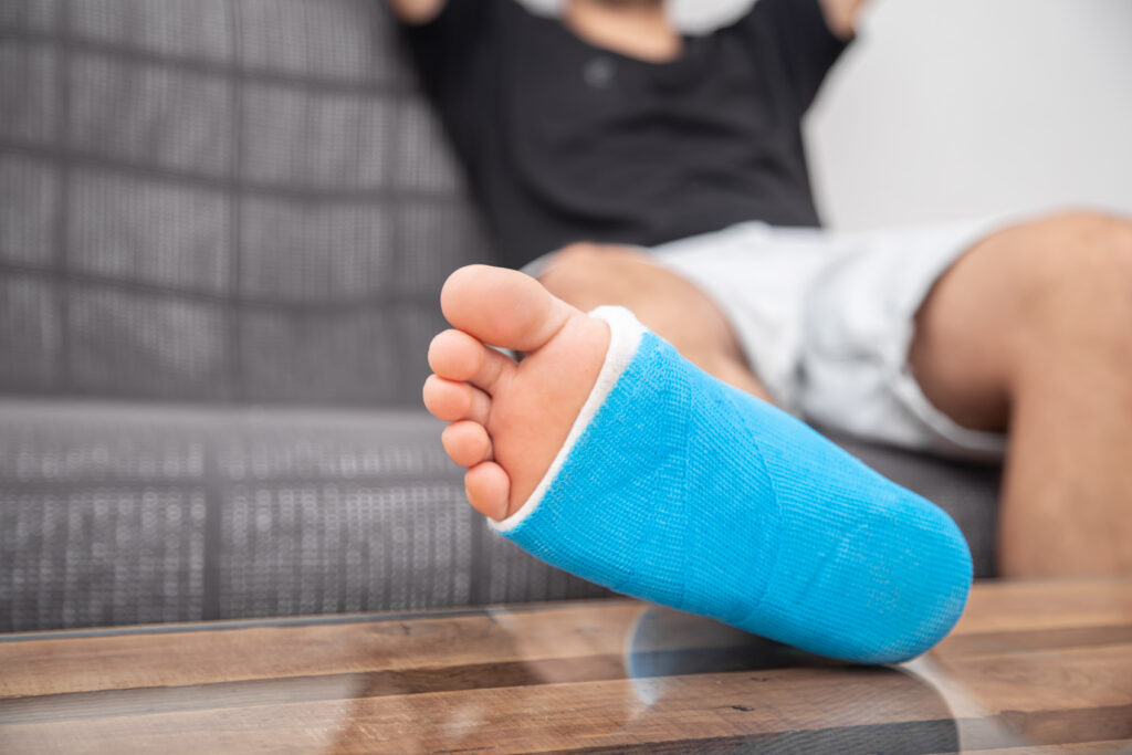 Man with broken leg in cast on couch at home. Sports injury concept.