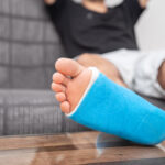 Man with broken leg in cast on couch at home. Sports injury concept.